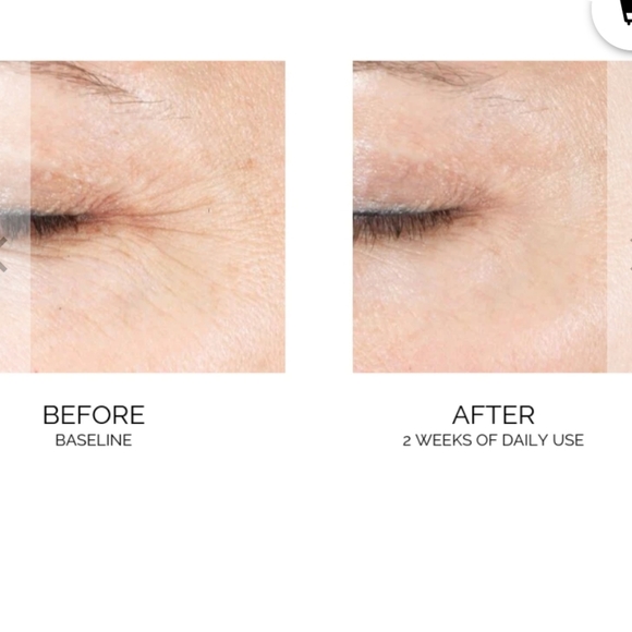 Kaplan MD Diamond Contour facial - Picture 10 of 11